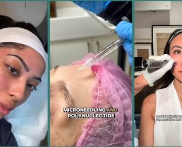 screen-shot-2025-05-2 Do Salmon Sperm Facials Really Work? Skin Pros Weigh In